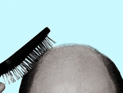 HAIR TRANSPLANTATION