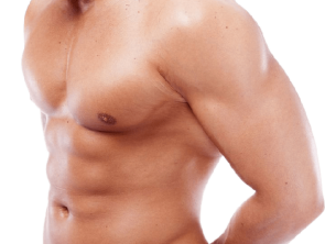 GYNECOMASTIA