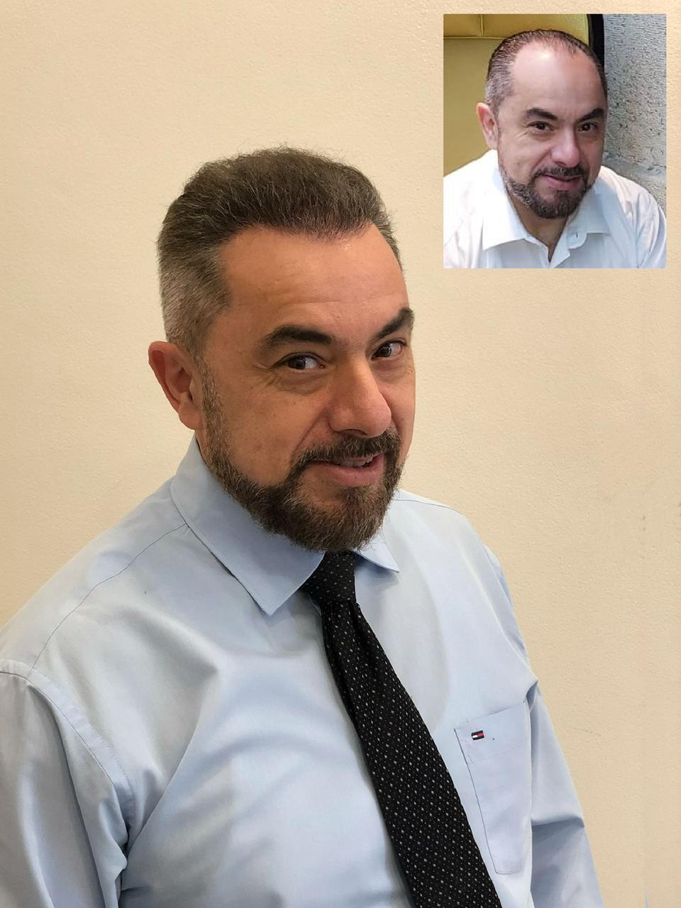 HAIR TRANSPLANTATION hair transplantation athens greece