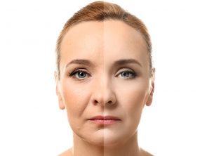 POLYLACTIC ACID (P.L.A.)