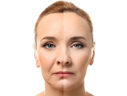 POLYLACTIC ACID (P.L.A.)