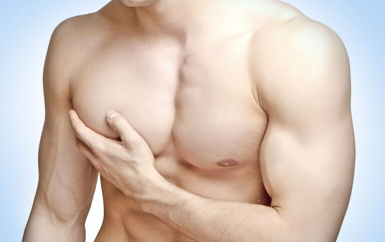 Gynecomastia-Surgery